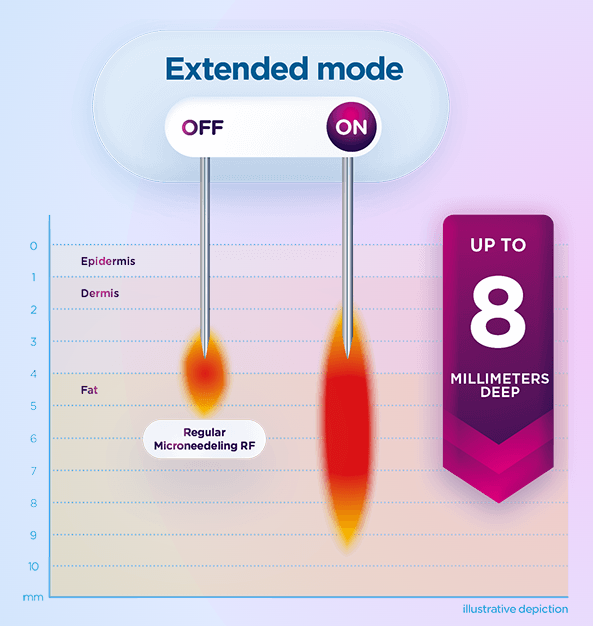EXION Fractional RF